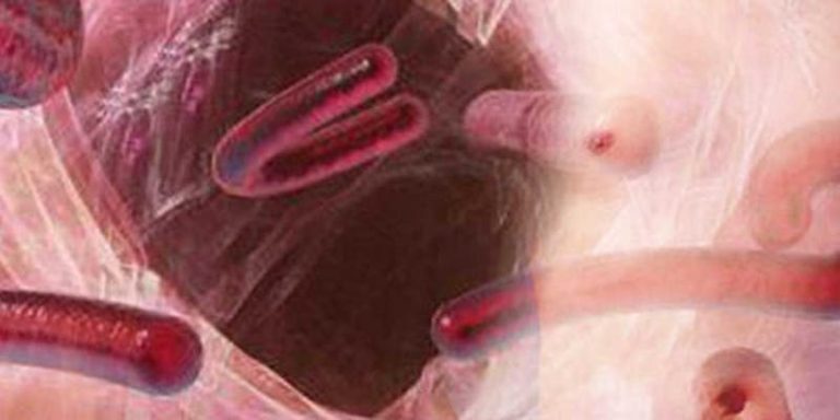 Ebola and Obesity, is it related?