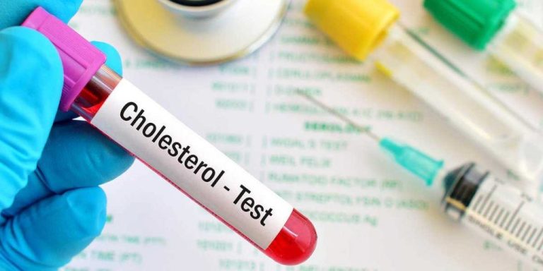 The truth about cholesterol