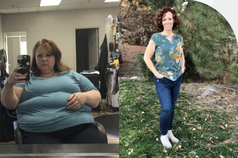 Patients Feel Safe At OCC As COVID-19 Makes Bariatric Surgery More Important Than Ever