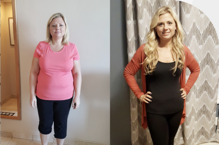 How Revision Surgery At OCC Can Turn A Failed Bariatric Procedure Into A Success