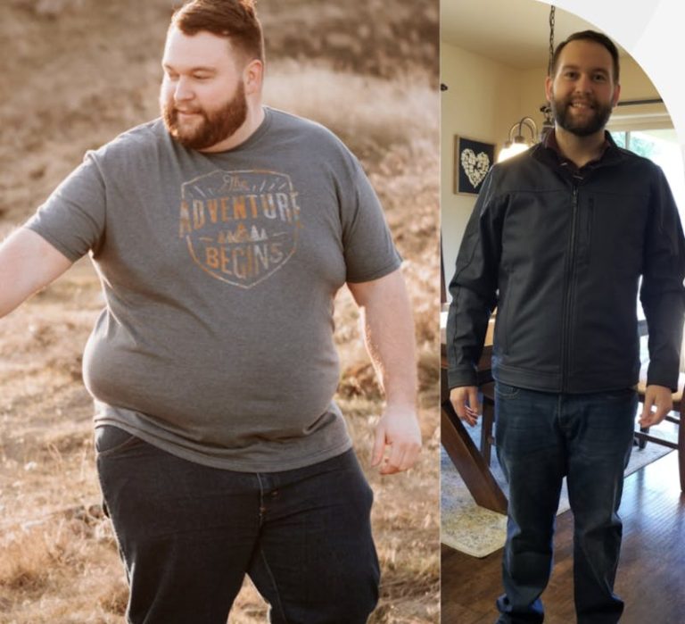 5 Ways to Mentally and Emotionally Prepare for Your Bariatric Procedure