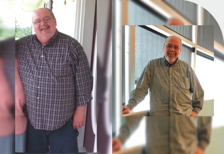 Why Bariatric Surgery After 50+ Is Possible