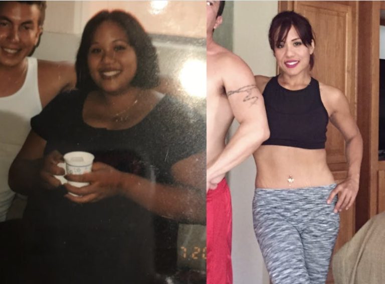 Be A True Biggest Loser With Weight Loss Surgery At Obesity Control Center