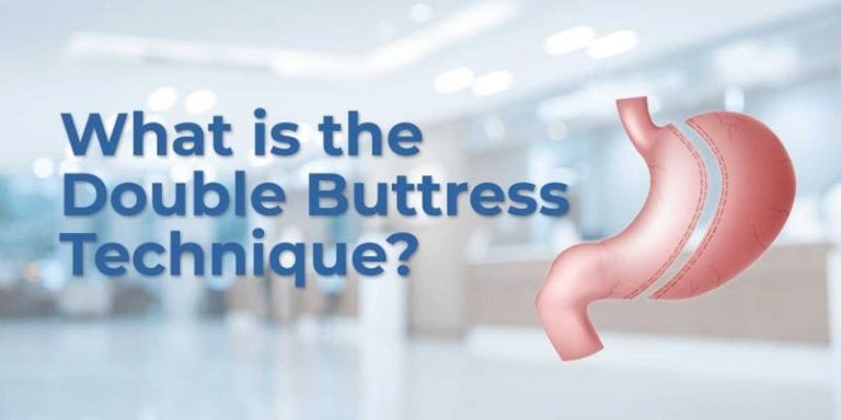 The Double Buttress Technique, an OCC Exclusive