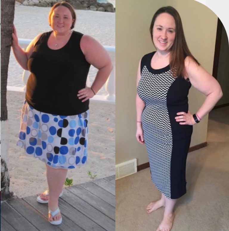 OCC Restores Patients’ Fertility with Gastric Sleeve Weight Loss Surgery
