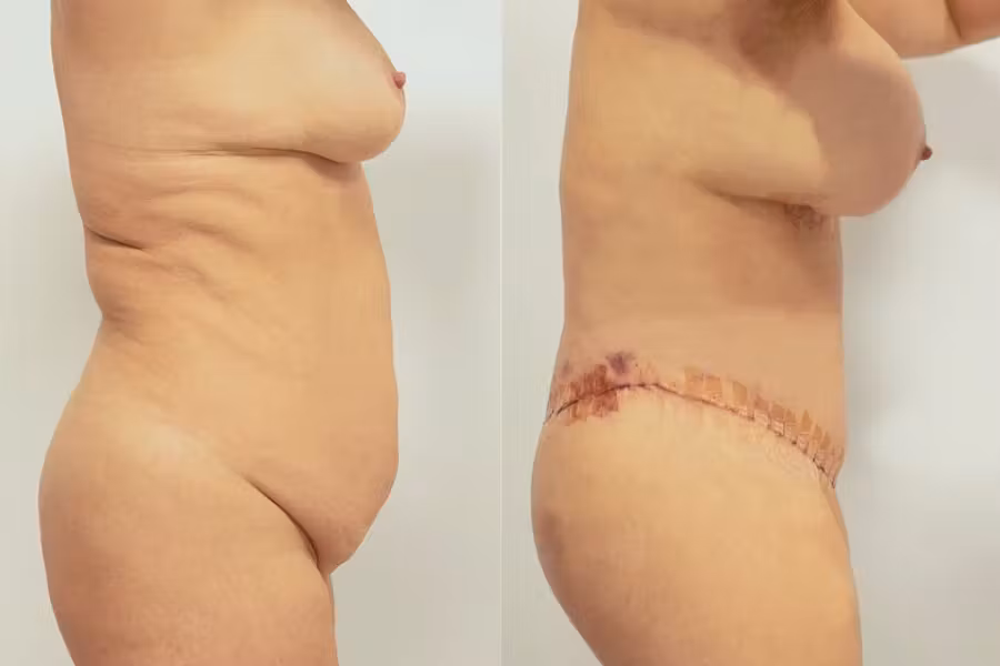 International Center of Excellence
